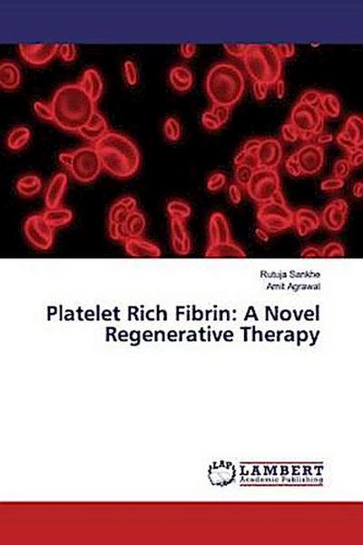 Platelet Rich Fibrin: A Novel Regenerative Therapy