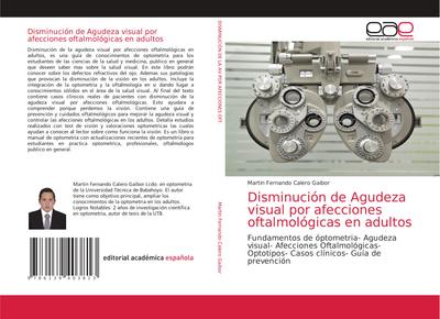 Disminución de Agudeza visual por afecciones oftalmológicas en adultos