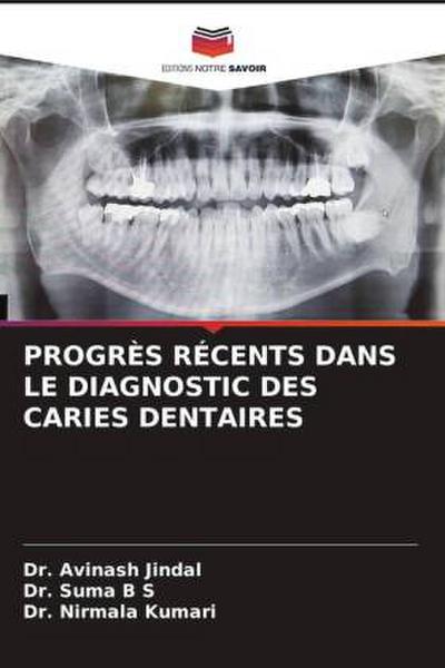 PROGRÈS RÉCENTS DANS LE DIAGNOSTIC DES CARIES DENTAIRES