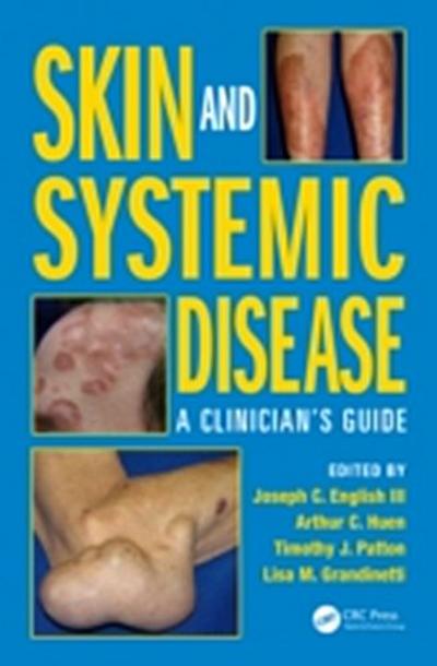 Skin and Systemic Disease