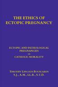 The Ethics of Ectopic pregnancy