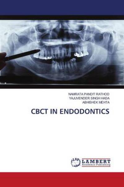 CBCT IN ENDODONTICS