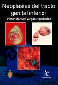 Neoplasias del tracto genital inferior