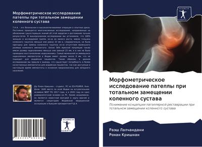 Morfometricheskoe issledowanie patelly pri total’nom zameschenii kolennogo sustawa