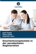 Knochentransplantate in der parodontalen Regenerat