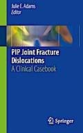 PIP Joint Fracture Dislocations