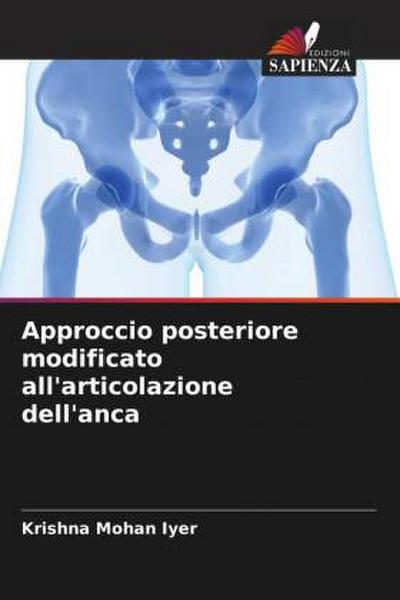 Approccio posteriore modificato all’articolazione dell’anca