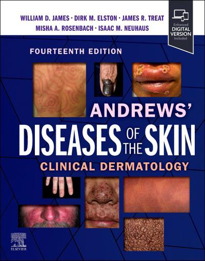 Andrews’ Diseases of the Skin