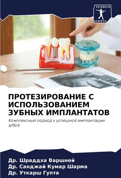 PROTEZIROVANIE S ISPOL’ZOVANIEM ZUBNYH IMPLANTATOV