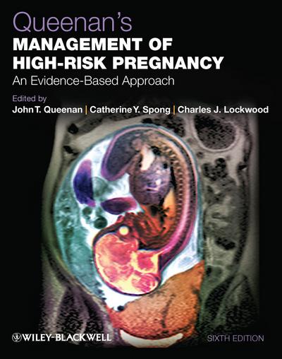 Queenan’s Management of High-Risk Pregnancy