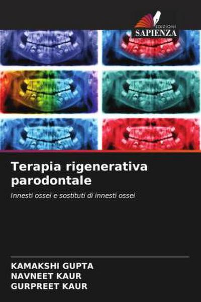 Terapia rigenerativa parodontale