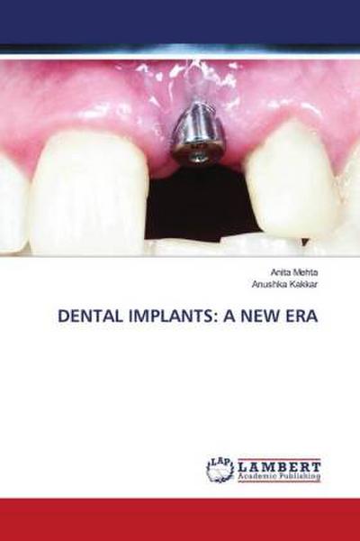 DENTAL IMPLANTS: A NEW ERA