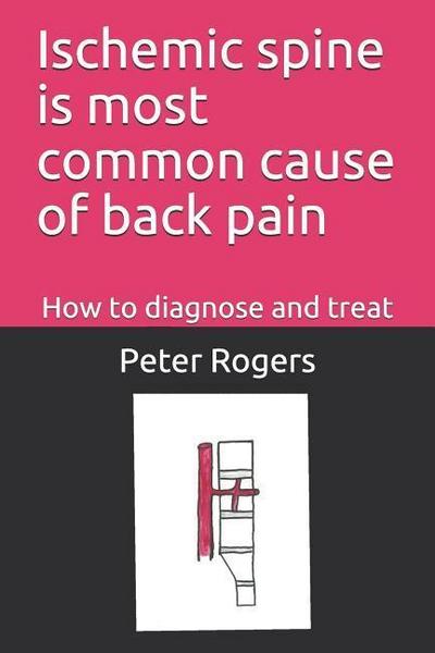 Ischemic Spine Is Most Common Cause of Back Pain: How to Diagnose and Treat