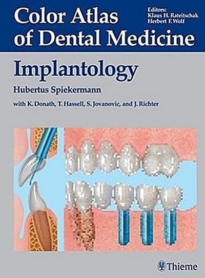 The Implantology: Microanatomy, Approaches and Techniques