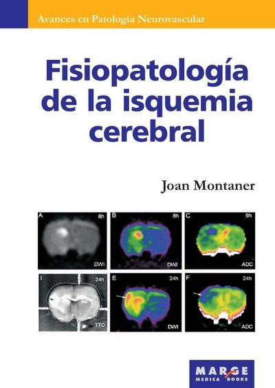 Fisiopatología de la isquemia cerebral