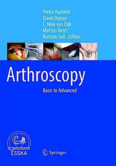 Arthroscopy