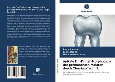 Apikale Ein-Drittel-Morphologie der permanenten Molaren durch Clearing-Technik