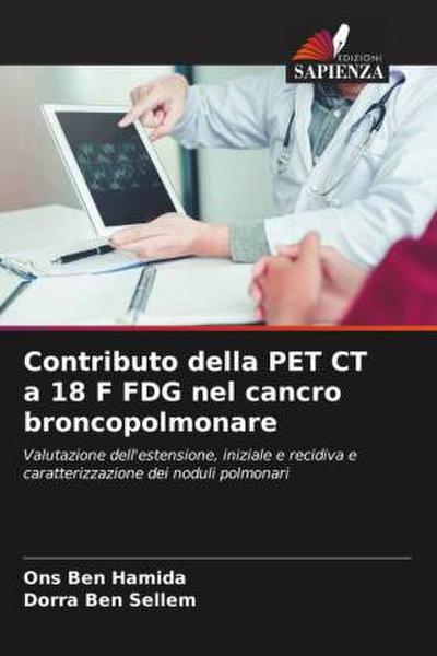 Contributo della PET CT a 18 F FDG nel cancro broncopolmonare