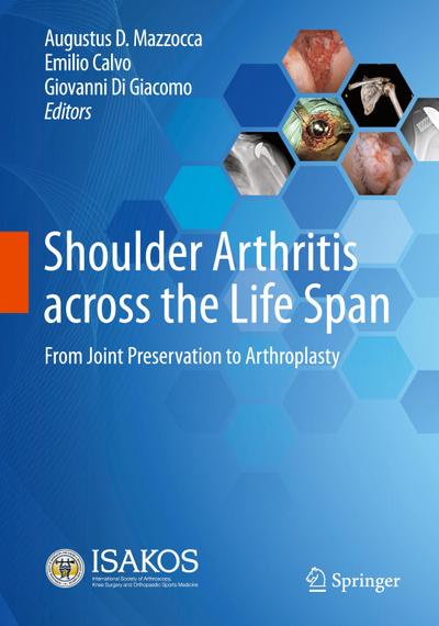 Shoulder Arthritis across the Life Span
