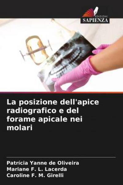 La posizione dell’apice radiografico e del forame apicale nei molari