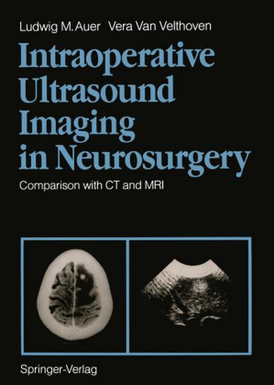 Intraoperative Ultrasound Imaging in Neurosurgery