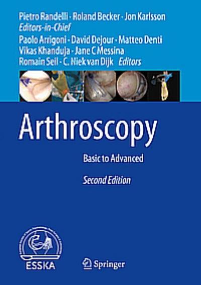 Arthroscopy