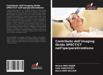 Contributo dell’imaging ibrido SPECT/CT nell’iperparatiroidismo