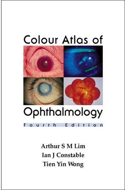Colour Atlas of Ophthalmology (Fourth Edition)