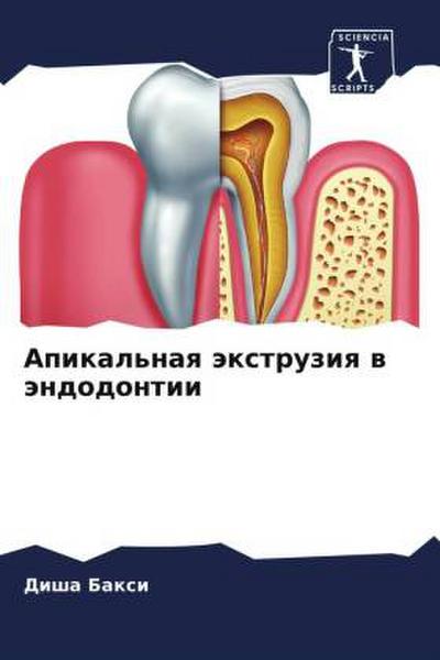 Apikal’naq äxtruziq w ändodontii