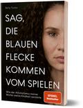 Sag, die blauen Flecke kommen vom Spielen von Betty Taube | Taschenbuch