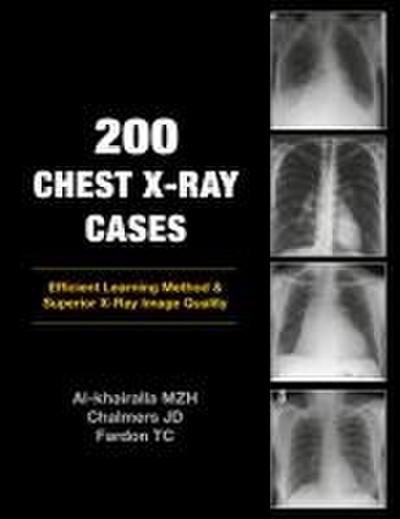 200 Chest X-Ray Cases