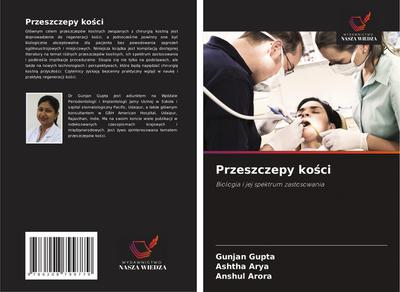Przeszczepy kosci