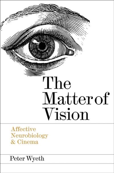 The Matter of Vision