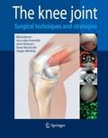 The Knee Joint