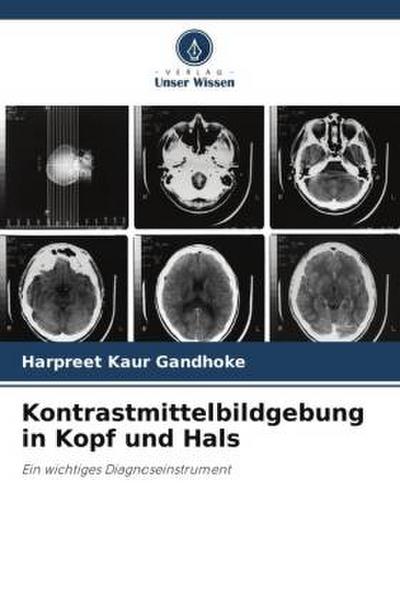 Kontrastmittelbildgebung in Kopf und Hals