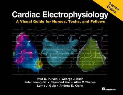 Cardiac Electrophysiology