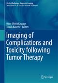 Imaging of Complications and Toxicity following Tu