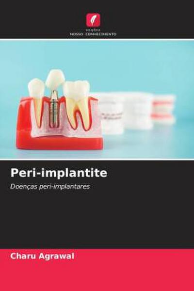 Peri-implantite