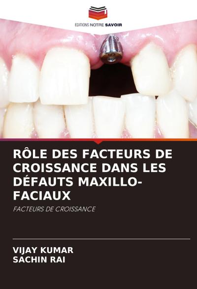 RÔLE DES FACTEURS DE CROISSANCE DANS LES DÉFAUTS MAXILLO-FACIAUX