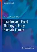 Imaging and Focal Therapy of Early Prostate Cancer