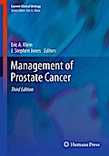 Management of Prostate Cancer