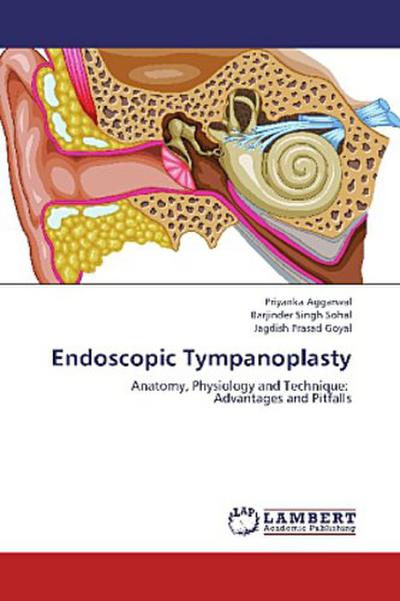 Endoscopic Tympanoplasty