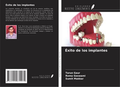 Éxito de los implantes