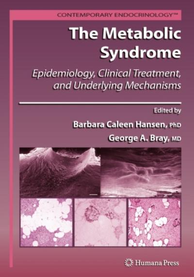 The Metabolic Syndrome: