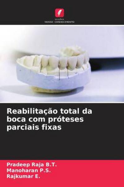 Reabilitação total da boca com próteses parciais fixas