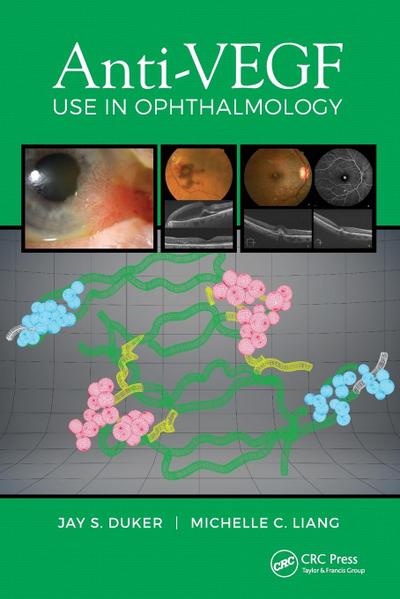 Anti-VEGF Use in Ophthalmology