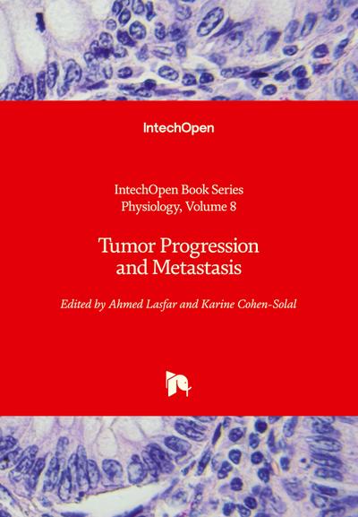 Tumor Progression and Metastasis