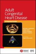 Adult Congenital Heart Disease