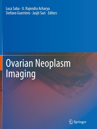 Ovarian Neoplasm Imaging