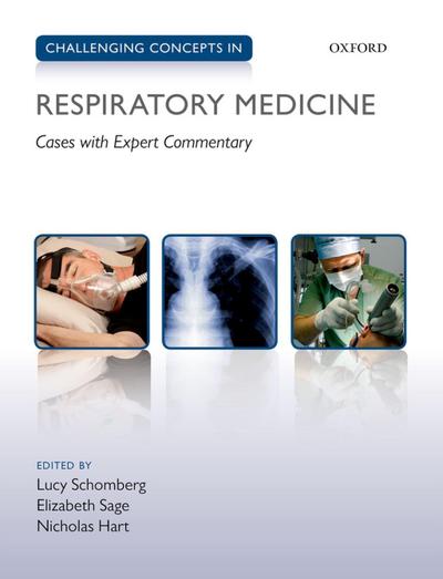 Challenging Concepts in Respiratory Medicine